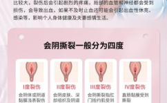 私密撕裂,揭秘女性私密健康之谜